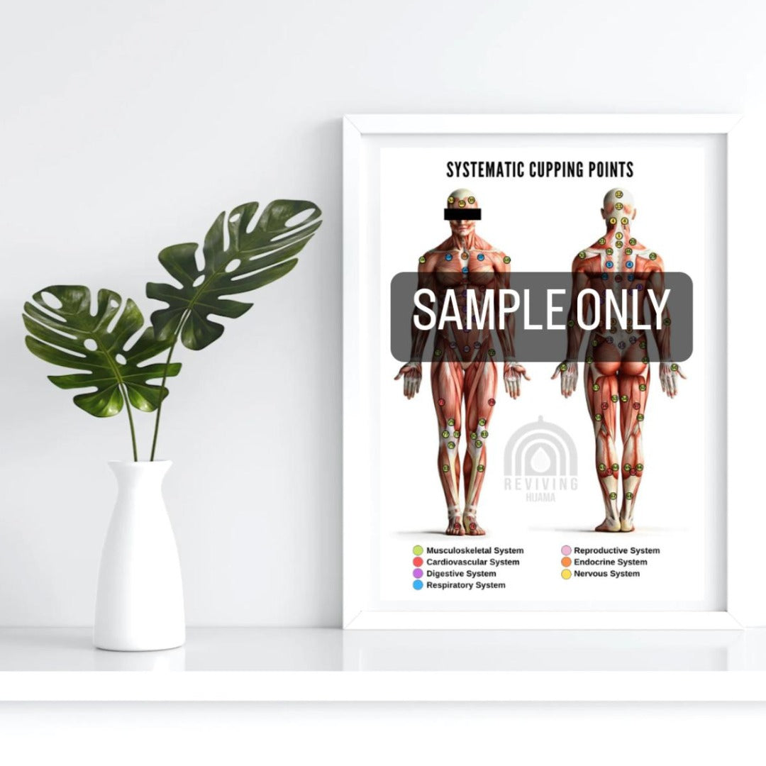 Systematic Cupping points diagram poster for Hijama