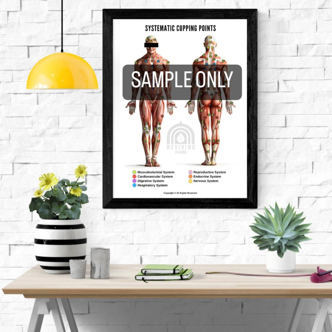 Systematic cupping points diagram poster for hijama